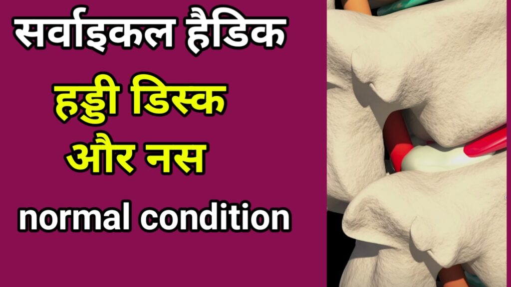 गर्दन की हड्डी से सिरदर्द क्यों होता है? कारण, लक्षण और आसान घरेलू उपाय