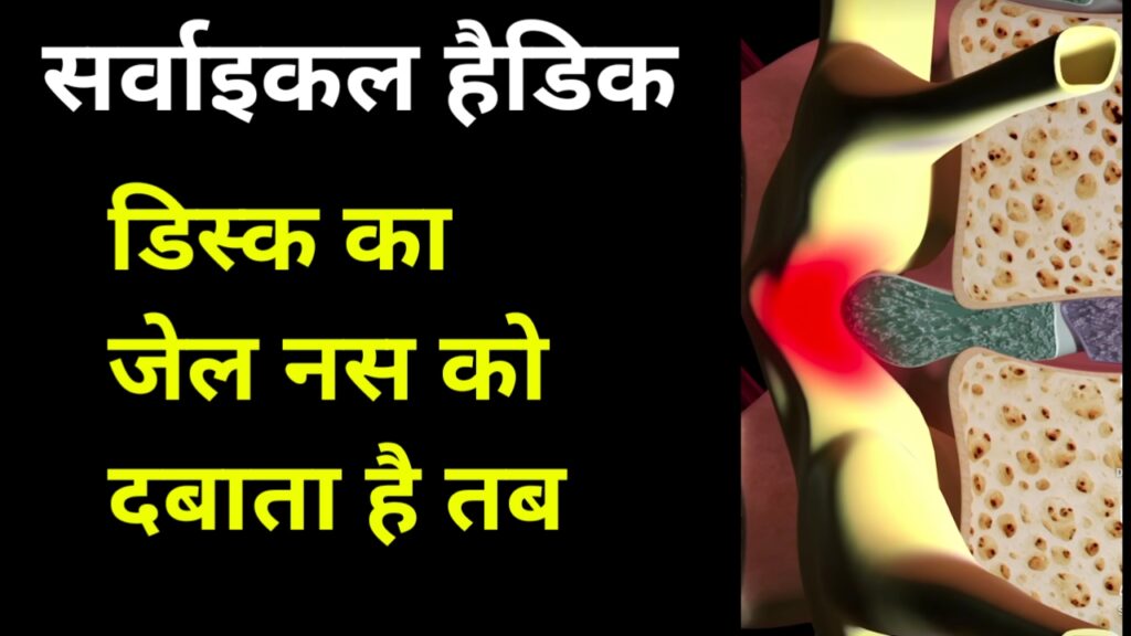 गर्दन की हड्डी से सिरदर्द क्यों होता है? कारण, लक्षण और आसान घरेलू उपाय