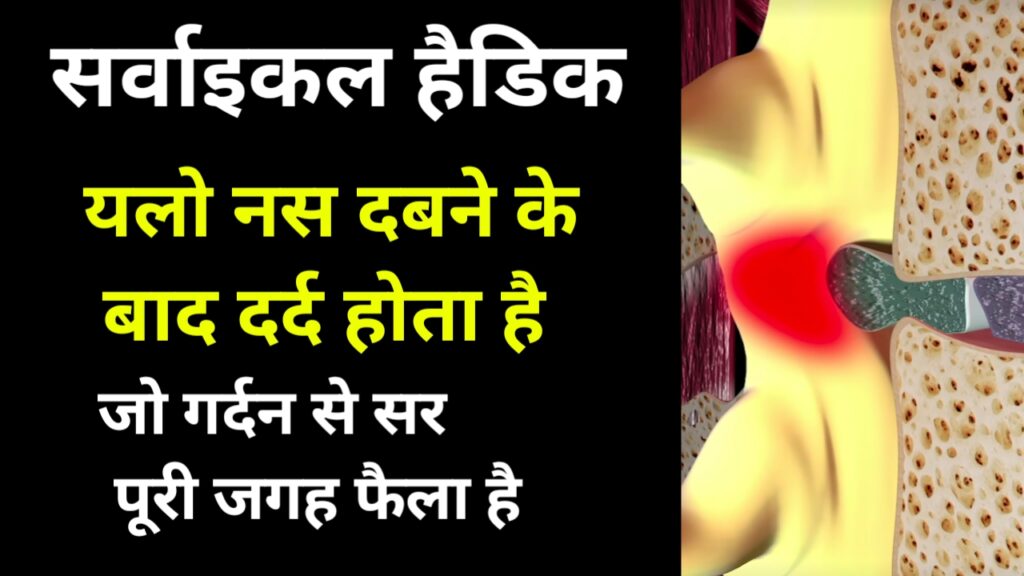 गर्दन की हड्डी से सिरदर्द क्यों होता है? कारण, लक्षण और आसान घरेलू उपाय